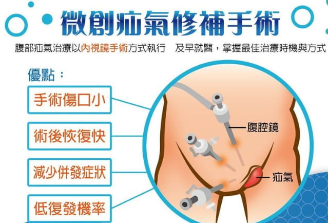 疝氣治療